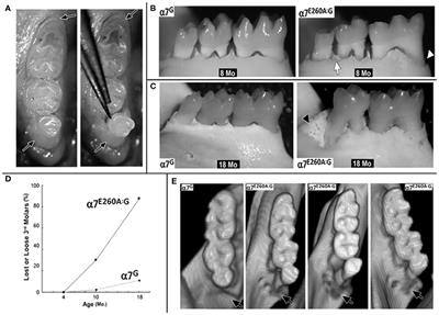Age-Associated <mark class="highlighted">Tooth Loss</mark> and Oral Microbial Dysbiosis in a Mouse Genetic Model of Chronic Nicotine Exposure